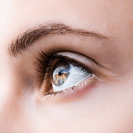IPL for Dry Eyes